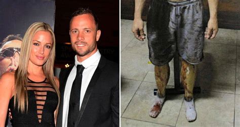 Reeva Steenkamp: Photos of Oscar Pistorius girlfriends dead。